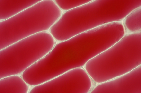 Cellules d'épiderme d'Oignon rouge x100